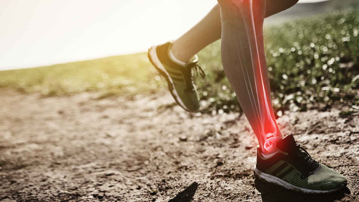 Shin Splints From Running: Causes, Prevention, and Recovery